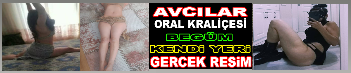 Platin ürün 28